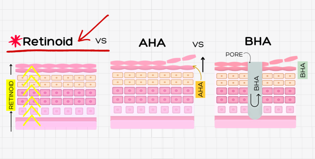 Retinoid-vs-aha-vs-bha