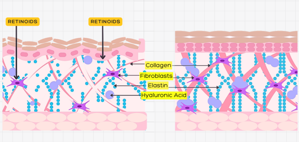 Retinoids_in_the_epidermis